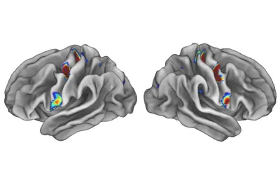 fMRI scan of two brains fMRI scan of two brains